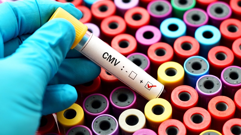 Cytomegalovirus (CMV) positive