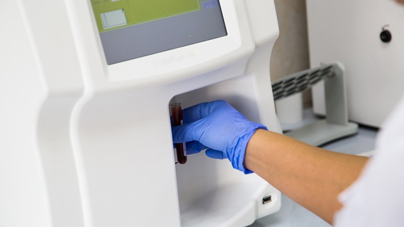 Blood haematology analyzer. Close up of medical worker in lab. - Image 