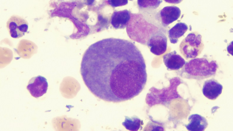 Mesothelial Cell