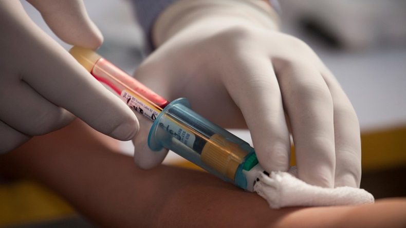 DRAWING BLOOD TO TEST FOR HIV. 