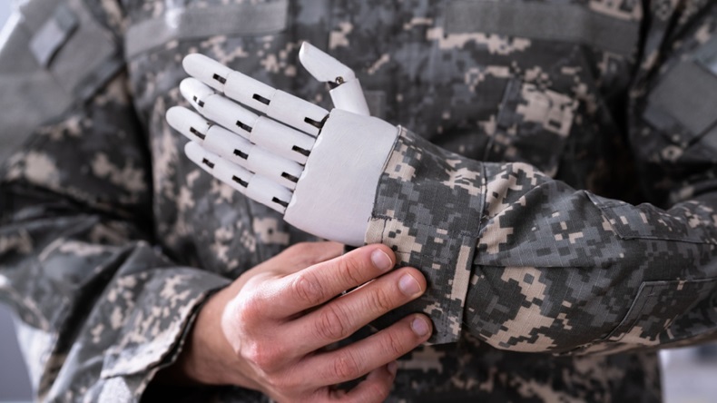 Soldier with a prosthetic hand.