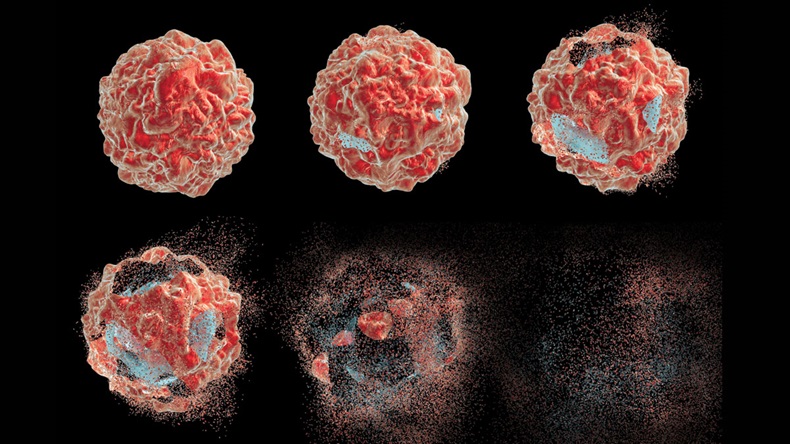 Series of images showing different stages of destruction of a tumor cell. 3D illustration. Can be used to illustrate effect of drugs, medicines, microbes, nanoparticles